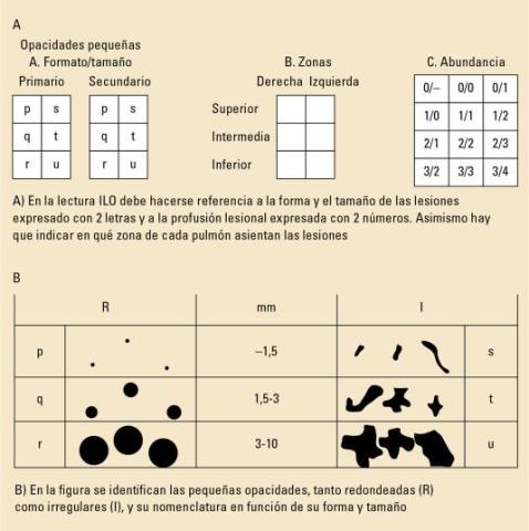 Protocolo sanitario de la silicosis